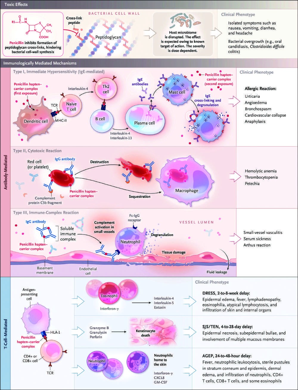 Clinical manifestations and mechanisms of immune-mediated cytotoxic reactions, and immune...