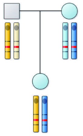Diagram of possible mechanisms for tumor formation in an individual...