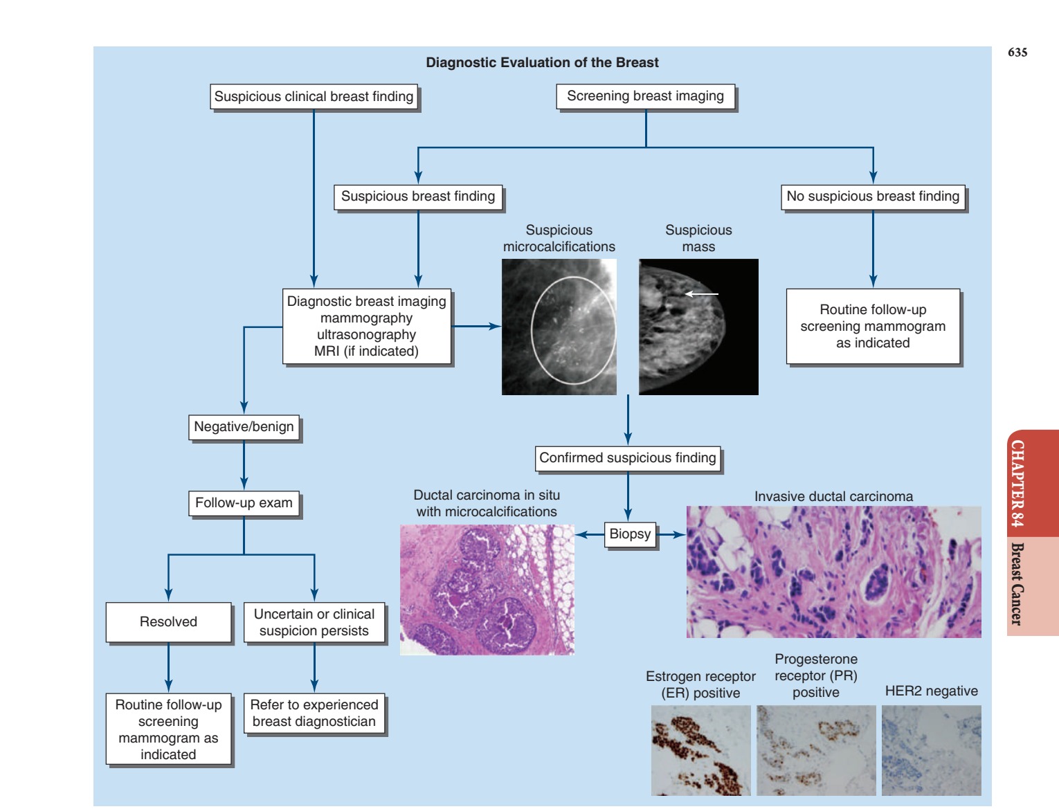 Evaluation and workup of breast lesions