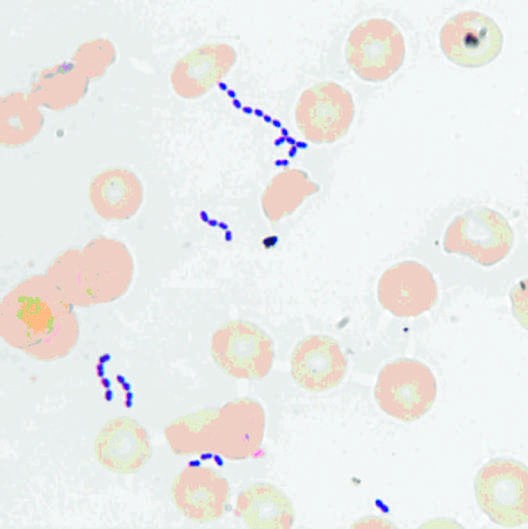 CHAPTER 154 FIGURE 154-1 Gram’s stain of cultured blood from...