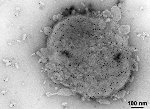 Electron micrograph of Neisseria meningitidis