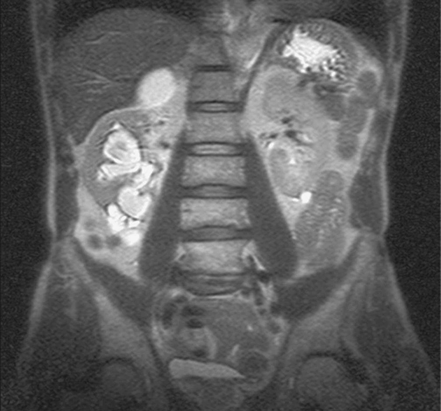 may involve any portion of the genitourinary tract