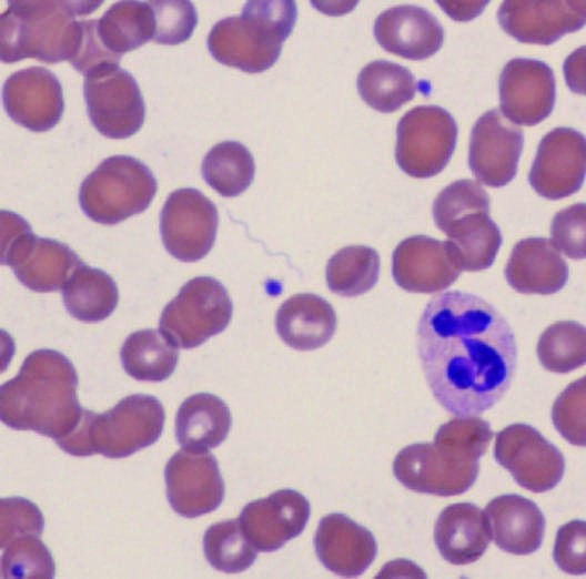 Photomicrograph of tick-borne relapsing fever spirochete (Borrelia Under conditions of...
