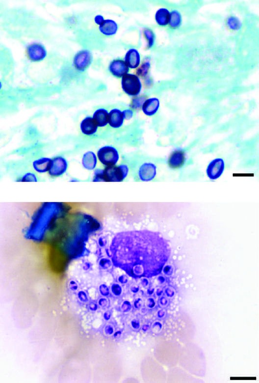 Spiked spherical conidia of H