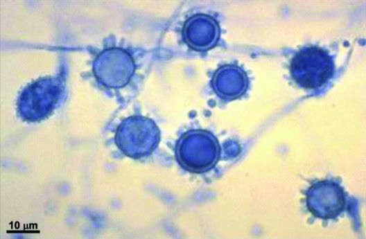 Spiked spherical conidia of H