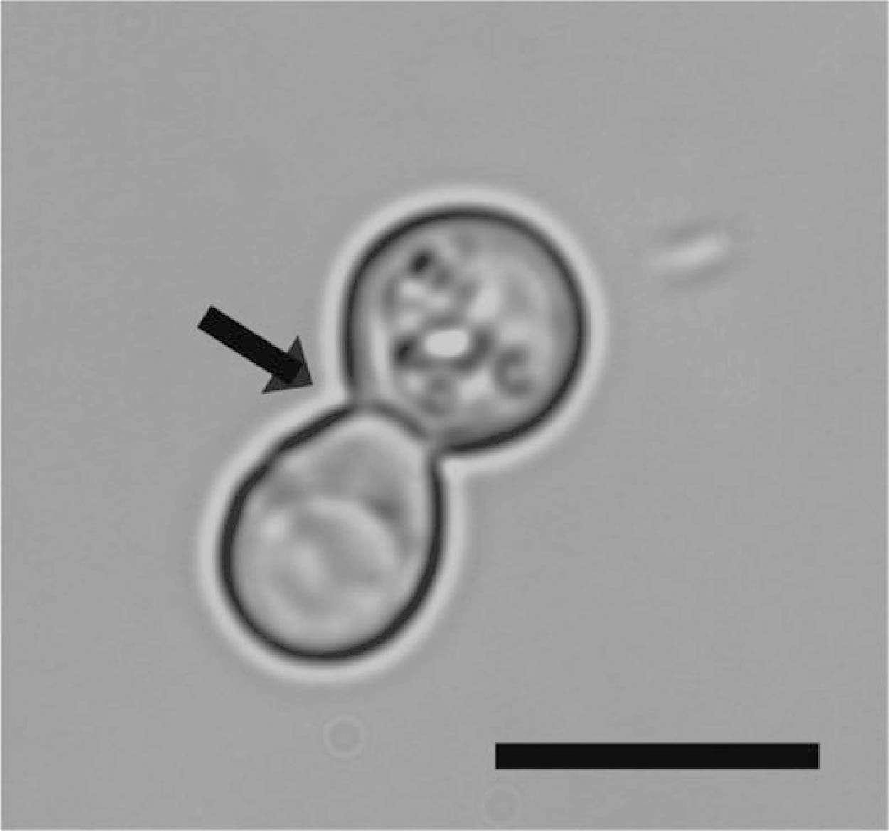 Blastomyces yeast at 37°C, with broad-based budding between cosis in...