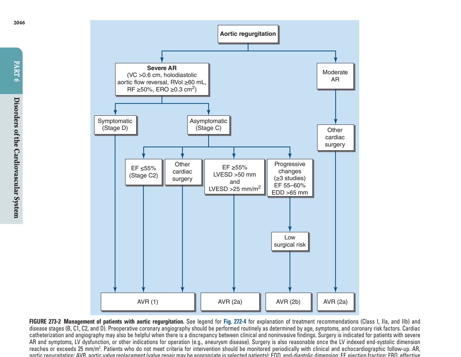 Management of patients with aortic regurgitation