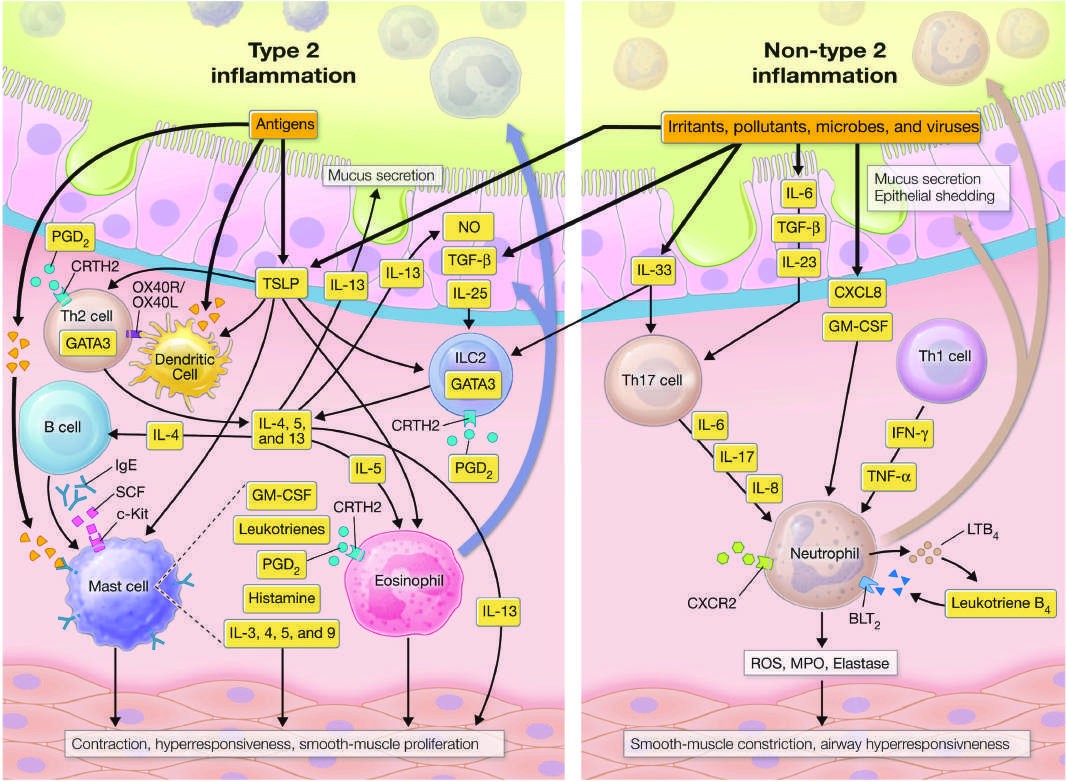 Inflammatory cells and mediators involved in type 2 and non–type...