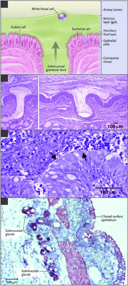 Extrusion of mucus secretion onto the epithelial surface of reticulum...