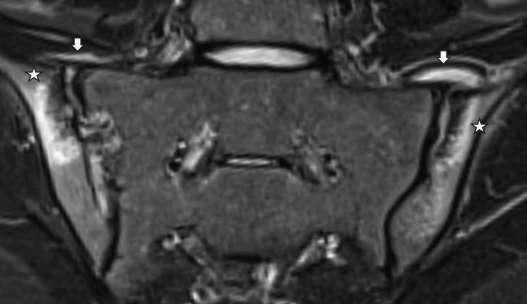 Computed tomography of the thoracic spine sagittal view in radiographic...