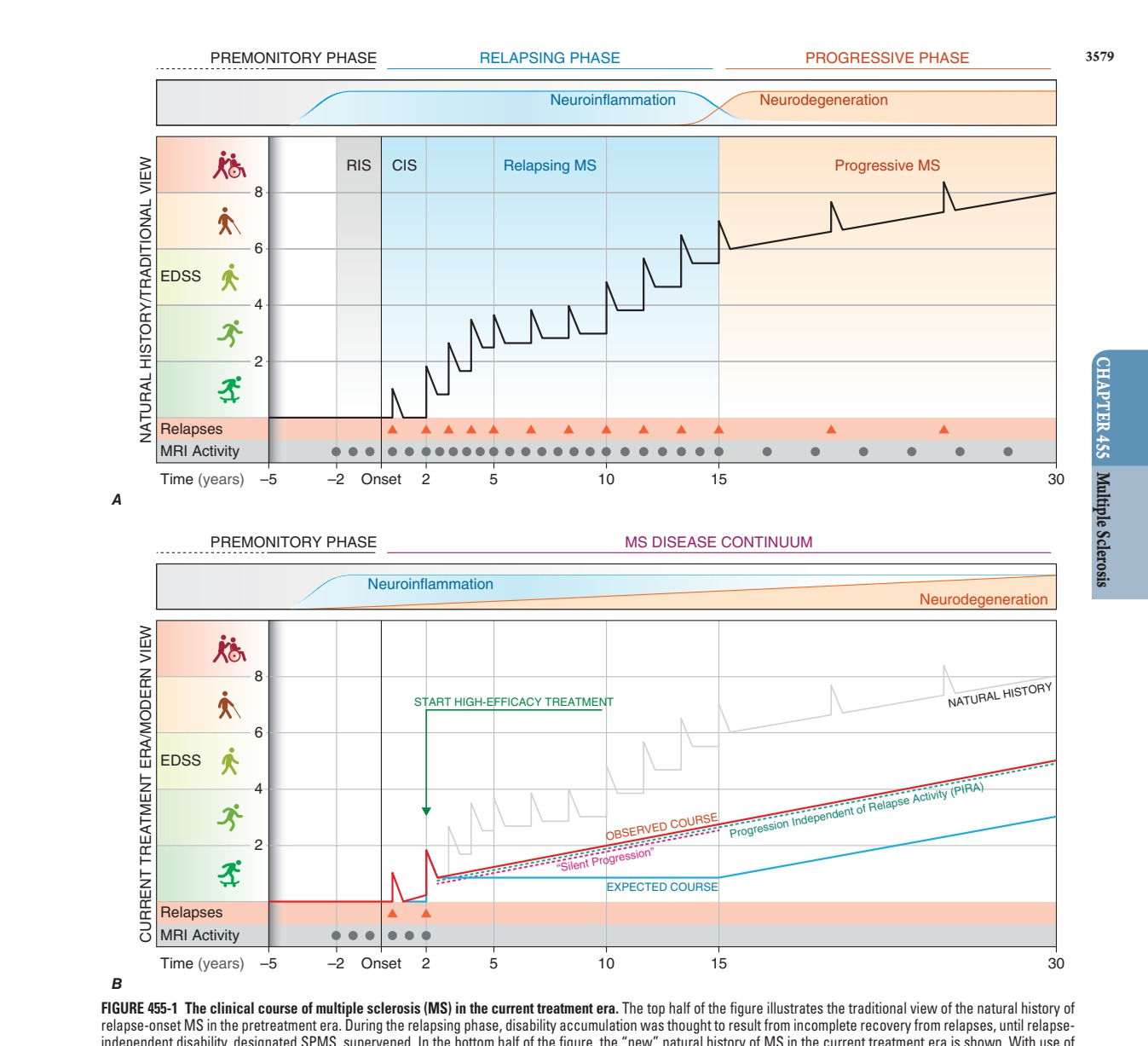 The clinical course of multiple sclerosis (MS) in the current...