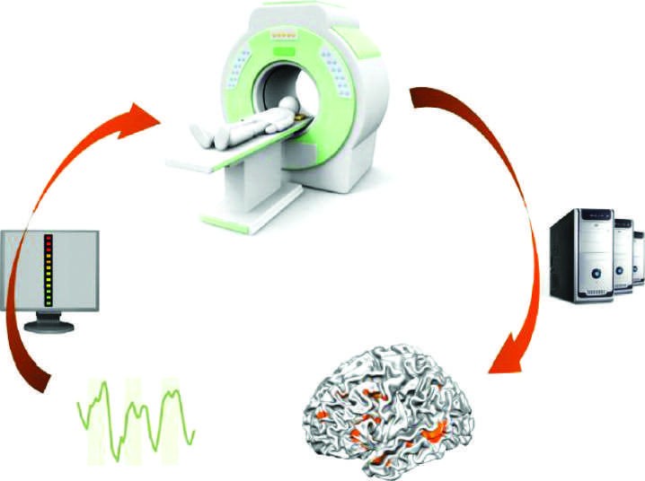 Neurofeedback using functional magnetic resonance imaging (fMRI)