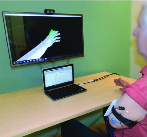 Augmented reality (AR) for phantom limb pain