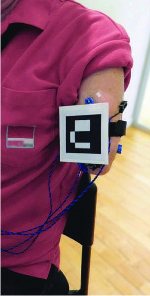 Augmented reality (AR) for phantom limb pain